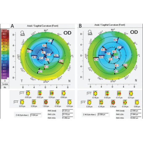 03 Actionable Insights